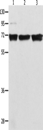 Anti-Human/Mouse RELA Antibody - ABMIUM