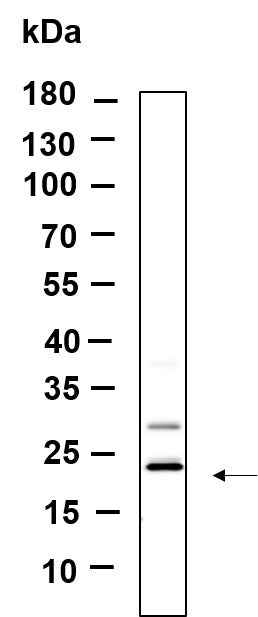 Anti-Human/Mouse/Rat KLLN Antibody [B983] - ABMIUM