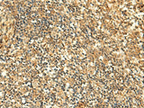 Immunohistochemistry of paraffin-embedded Human tonsil tissue using GLYATL2 Polyclonal Antibody at dilution of 1:50(×200)