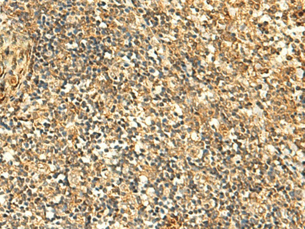 Immunohistochemistry of paraffin-embedded Human tonsil tissue using GLYATL2 Polyclonal Antibody at dilution of 1:50(×200)