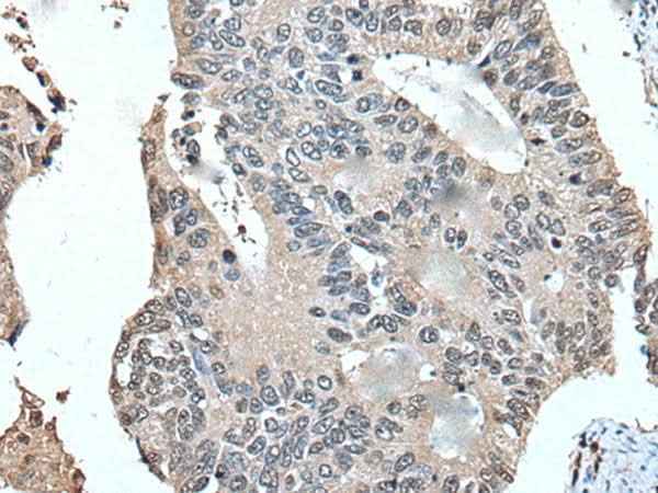 Anti-Human/Mouse/Rat UFM1 Antibody