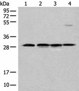 Western blot analysis of Human urinary bladder tissue Mouse heart tissue Mouse kidney tissue and RAW264.7 cell lysates using CA7 Polyclonal Antibody at dilution of 1:500