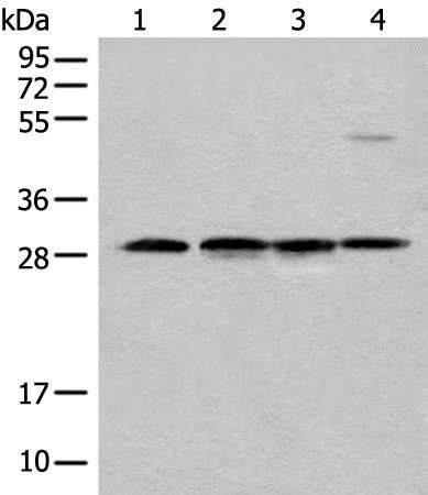 Western blot analysis of Human urinary bladder tissue Mouse heart tissue Mouse kidney tissue and RAW264.7 cell lysates using CA7 Polyclonal Antibody at dilution of 1:500