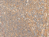 Immunohistochemistry of paraffin-embedded Human tonsil tissue using HPCA Polyclonal Antibody at dilution of 1:55(×200)