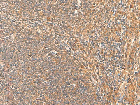 Immunohistochemistry of paraffin-embedded Human tonsil tissue using HPCA Polyclonal Antibody at dilution of 1:55(×200)