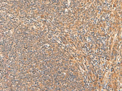 Immunohistochemistry of paraffin-embedded Human tonsil tissue using HPCA Polyclonal Antibody at dilution of 1:55(×200)