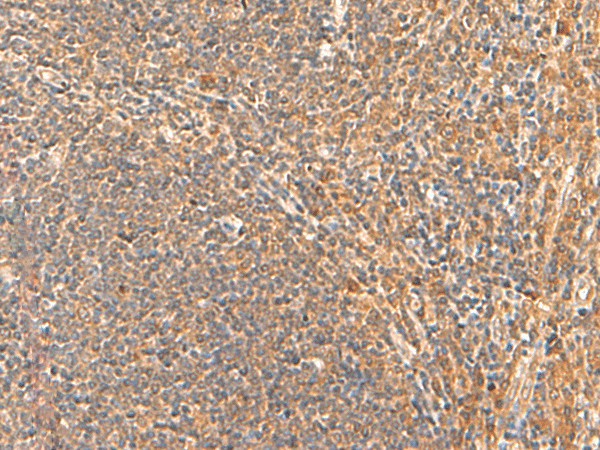 Immunohistochemistry of paraffin-embedded Human tonsil tissue using HPCA Polyclonal Antibody at dilution of 1:55(×200)