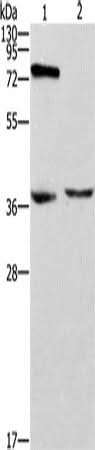 Western blot analysis of Jurkat cells mouse thymus tissue using ZAP70 Polyclonal Antibody at dilution of 1:1000