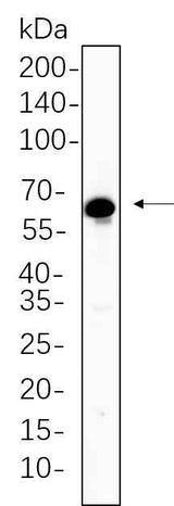 Anti-Human/Mouse/Rat TGF β Receptor II Antibody [B1140]