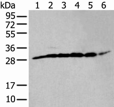 Anti-Human/Mouse/Rat ETFB Antibody