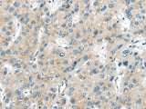 Anti-Human/Mouse/Rat VPS26A Antibody - ABMIUM