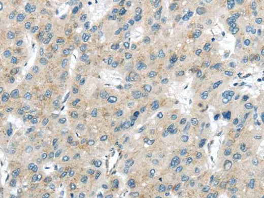 Anti-Human/Mouse/Rat VPS26A Antibody