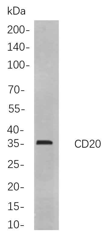 Anti-Human CD20 Antibody [B855] - ABMIUM