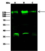 Anti-Human NCSTN Antibody [B317]