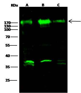 Anti-Human NCSTN Antibody [B317] - ABMIUM