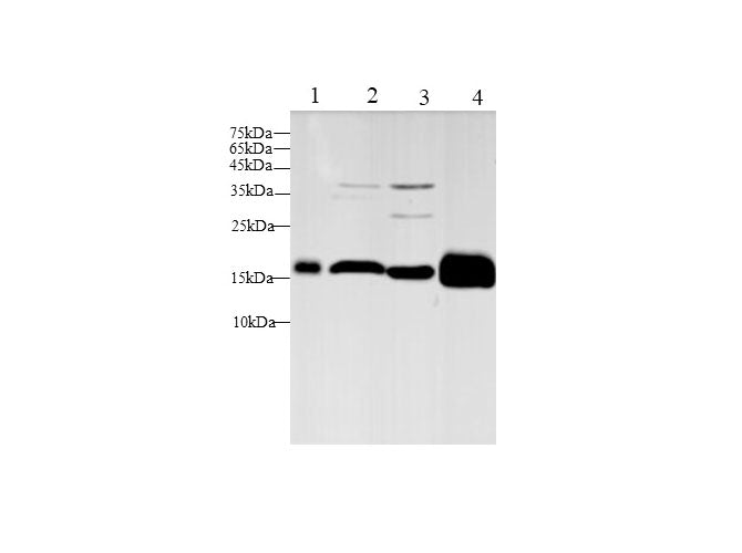 Anti-Mouse/Rat Fth1 Antibody - ABMIUM