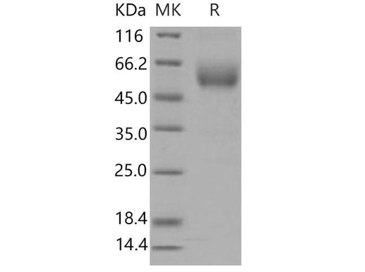 Recombinant Mouse SIGIRR/TIR8 Protein (His & Fc Tag) - ABMIUM