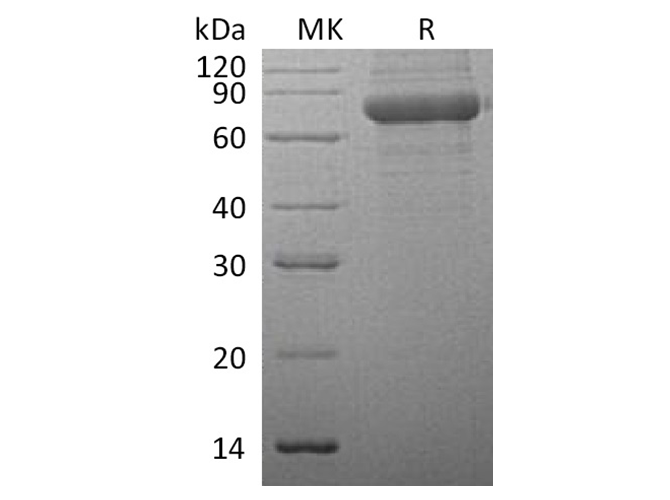 Recombinant Human TPP1/CLN2 Protein (His Tag) - ABMIUM
