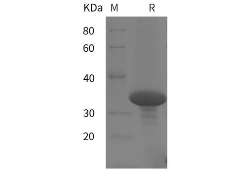 SDS-PAGE analysis of Human HDAC1 proteins, 2 μg/lane of Recombinant Human HDAC1 proteins was resolved with SDS-PAGE under reducing conditions, showing bands at 35 kDa.