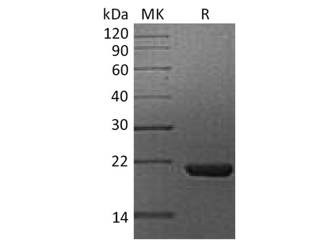 Recombinant Human Cyclophilin B/PPIB Protein (His Tag) - ABMIUM