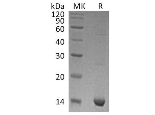 Recombinant Human S100A9 Protein - ABMIUM