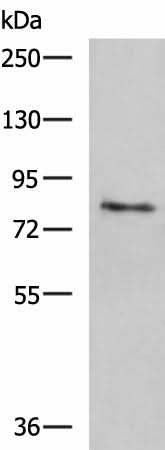 Western blot analysis of Human skin tissue lysate using TGM3 Polyclonal Antibody at dilution of 1:1600