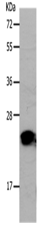 Anti-Human/Mouse/Rat PONC Antibody - ABMIUM