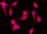 Anti-Human EIF4EBP1 Antibody [A1157] - ABMIUM