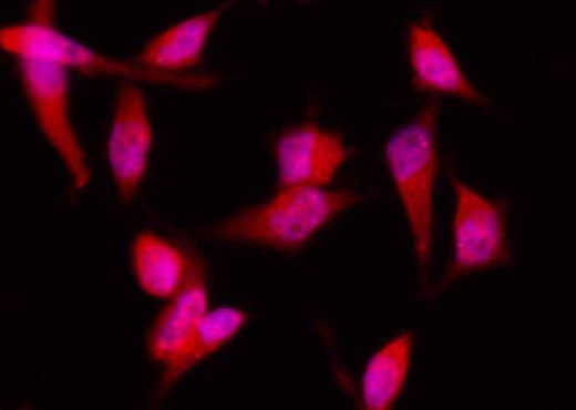 Anti-Human EIF4EBP1 Antibody [A1157] - ABMIUM
