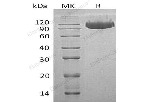 Recombinant Human SerpinG1/C1IN Protein (His Tag) - ABMIUM