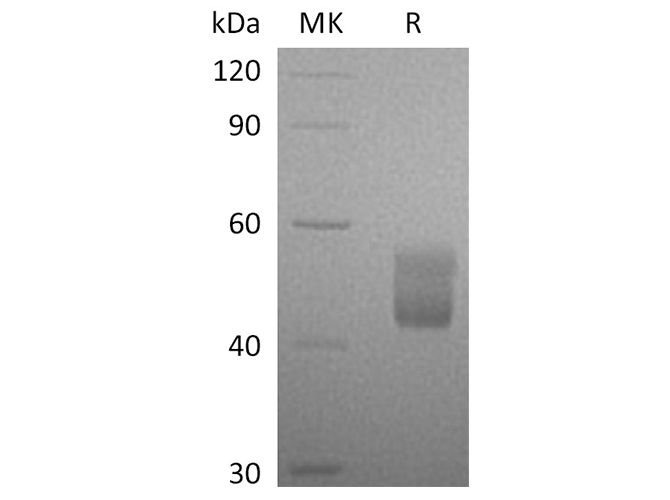 Recombinant Human CFHR3 Protein (His Tag) - ABMIUM