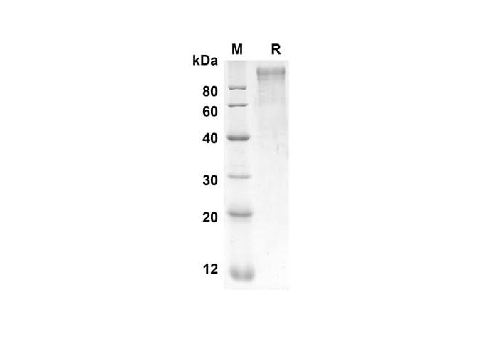 SDS-PAGE analysis of Rat SELP proteins, 2 μg/lane of Recombinant Rat SELP proteins was resolved with SDS-PAGE under reducing conditions, showing bands at 73.4 kDa.