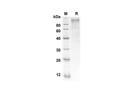 SDS-PAGE analysis of Rat SELP proteins, 2 μg/lane of Recombinant Rat SELP proteins was resolved with SDS-PAGE under reducing conditions, showing bands at 73.4 kDa.