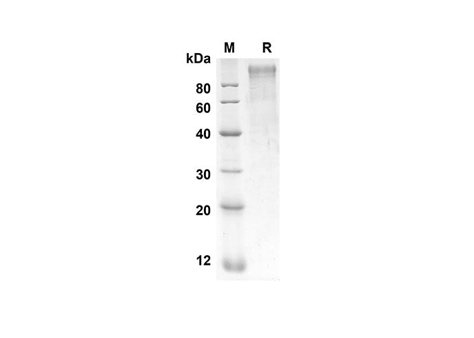SDS-PAGE analysis of Rat SELP proteins, 2 μg/lane of Recombinant Rat SELP proteins was resolved with SDS-PAGE under reducing conditions, showing bands at 73.4 kDa.