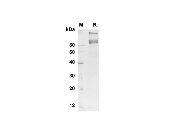 SDS-PAGE analysis of Mouse BCAM proteins , 2 μg/lane of Recombinant Mouse BCAM proteins was resolved with SDS-PAGE under reducing conditions , showing bands at 90 kDa.
