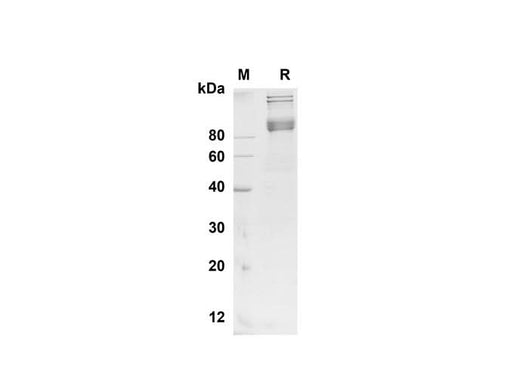 SDS-PAGE analysis of Mouse BCAM proteins , 2 μg/lane of Recombinant Mouse BCAM proteins was resolved with SDS-PAGE under reducing conditions , showing bands at 90 kDa.