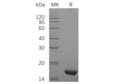 Recombinant Human PMP2/FABP8 Protein (His Tag) - ABMIUM