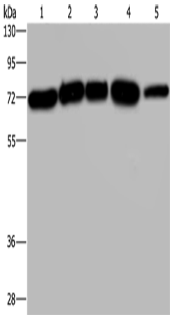 Anti-Human/Mouse/Rat AGFG1 Antibody - ABMIUM