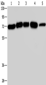 Anti-Human/Mouse/Rat AGFG1 Antibody - ABMIUM