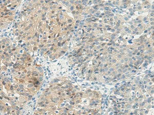 Anti-Human TBXA2R Antibody
