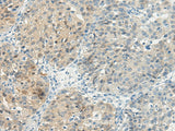 Anti-Human TBXA2R Antibody - ABMIUM
