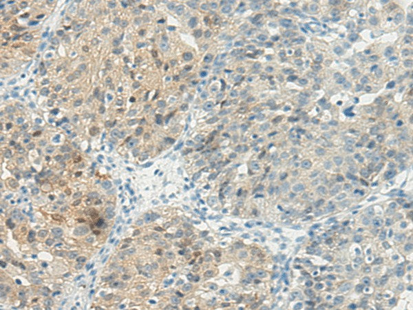 Anti-Human TBXA2R Antibody - ABMIUM