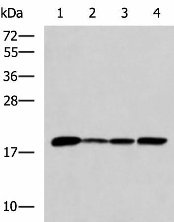Western blot analysis of K562 Jurkat HepG2 cell Human fetal intestines tissue lysates using AK6 Polyclonal Antibody at dilution of 1:800