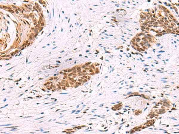 Anti-Human/Mouse/Rat CREBBP Antibody