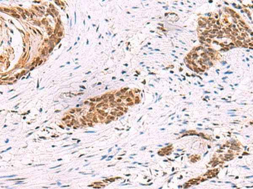 Anti-Human/Mouse/Rat CREBBP Antibody