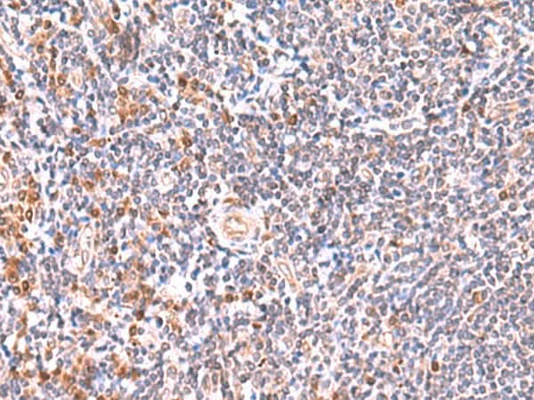 Immunohistochemistry of paraffin-embedded Human tonsil tissue using GMDS Polyclonal Antibody at dilution of 1:55(×200)