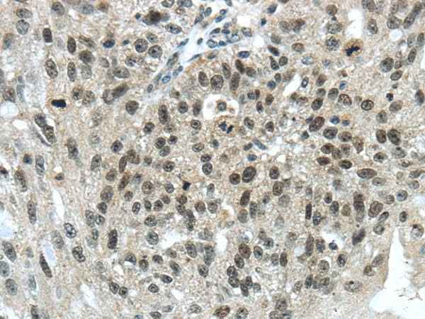 Anti-Human/Mouse TRIM24 Antibody