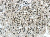 Anti-Human/Mouse TRIM24 Antibody - ABMIUM