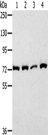 Anti-Human/Mouse/Rat CAPN1 Antibody - ABMIUM