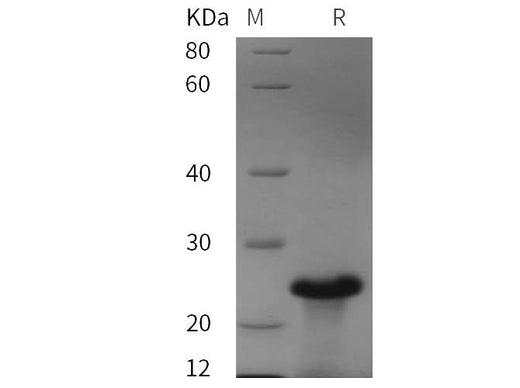 SDS-PAGE analysis of Human Orexin-A proteins, 2 μg/lane of Recombinant Human Orexin-A proteins was resolved with SDS-PAGE under reducing conditions, showing bands at 25 kDa.